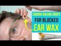Doctor explains how to use Medi Grade Sodium Bicarbonate drops to remove blocked EAR WAX