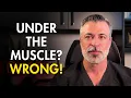 Breast Implants Under the Muscle A Plastic Surgeon Explains Why It s Outdated