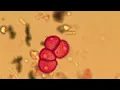 How scientists provide your daily allergy report