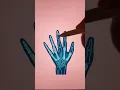 x-ray