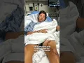 Florida man recounts surviving shark attack