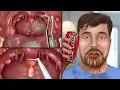 Lagu [ASMR Animation] Help MrBeast solve his cola bottle problem