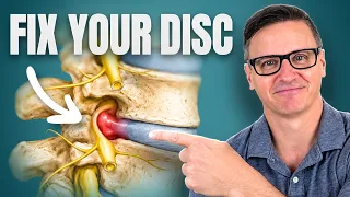Lumbar Disc Bulge? Do These 3 Exercises Every Day