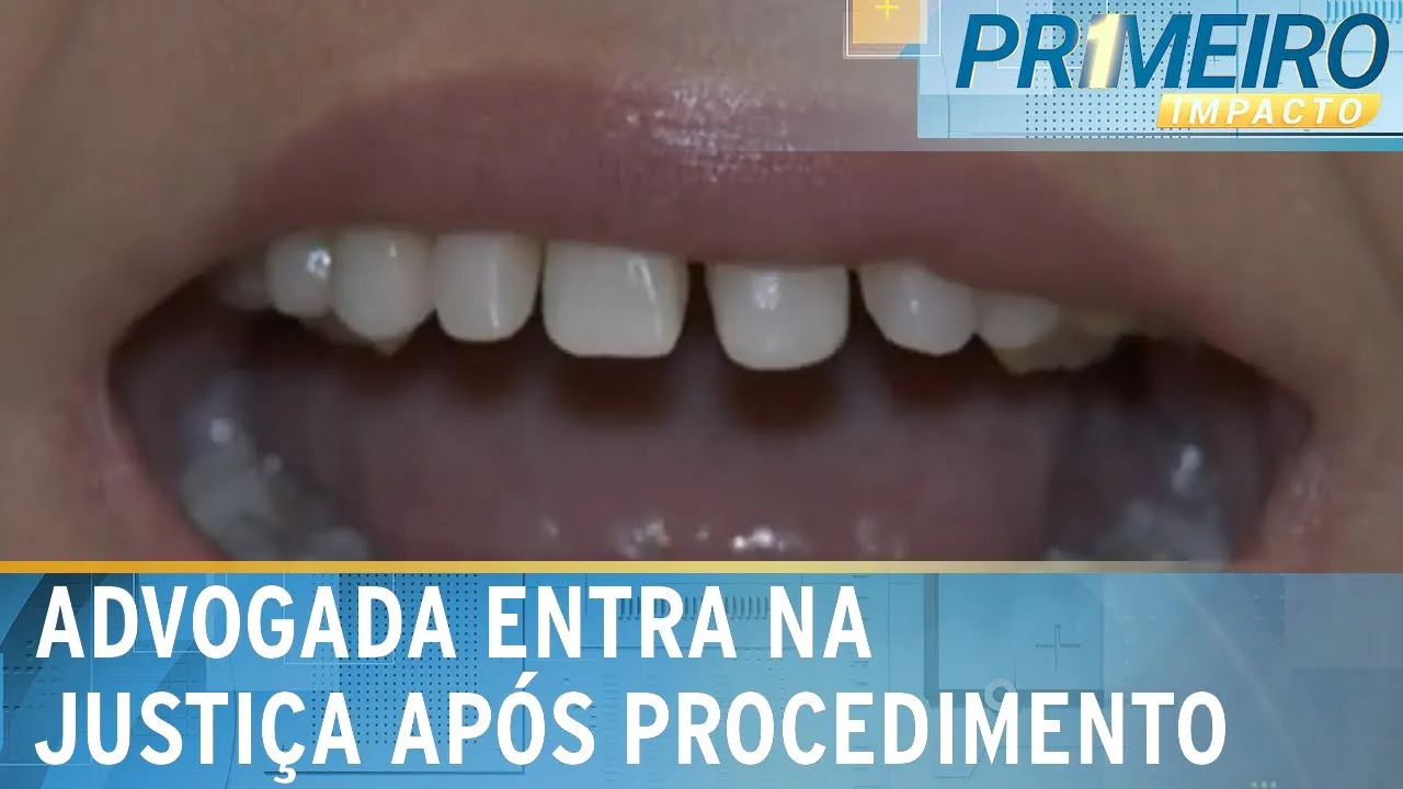 Resultado de tratamento dentário não agrada e mulher processa clínica | Primeiro Impacto (06/09/23)