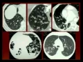 Radiology 4-28-16