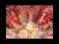 Ravi Shankar  Zahir Hussain & Partho Sarathi 1993, London,Albert Hall, Raga Kirvani1 clip0