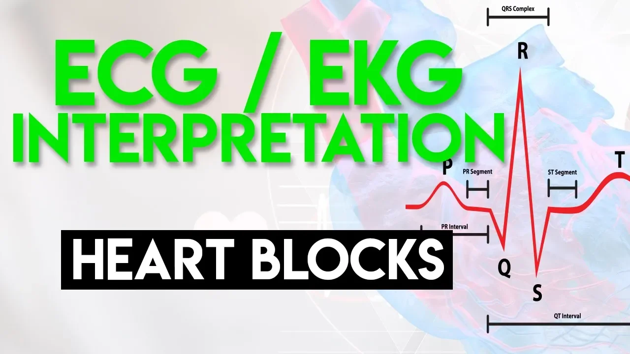 Heart Blocks Made Easy | ECG EKG Interpretation (Part 6)