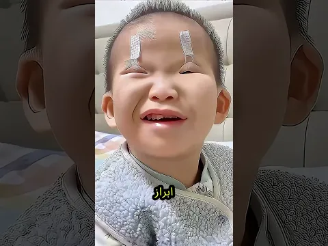 كيف يساعد هذا الشريط اللاصق الأطفال الصينيين على الرؤية أفضل؟😱😱 #ترند #اكسبلور #shorts  #trending