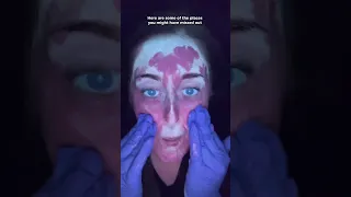 Applying SPF Under LED UV Light Dr Medispa 