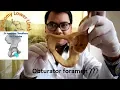 Obturator foramen