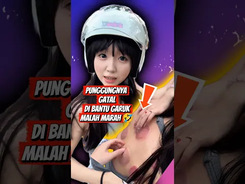 Gatel banget, di garuk malah marah 🤣 #shorts #shortvideo #shortsfeed