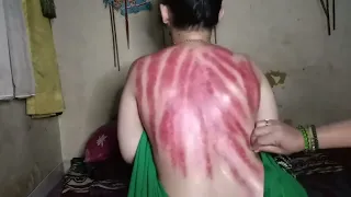 ibu cantik masuk angin wanita mulus kerokan masuk angin