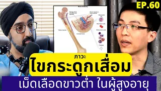  การรักษาภาวะไขกระดูกเสื่อมทำอย่างไร และมีทางเลือกอะไรบ้าง 