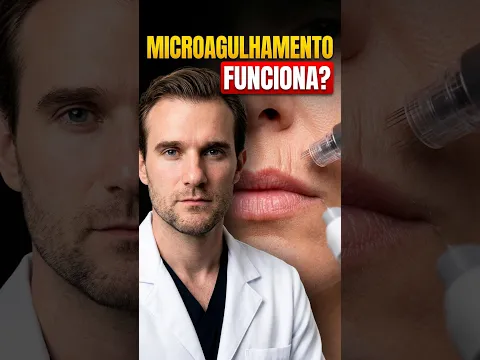 Microagulhamento Funciona no Código de Barras?