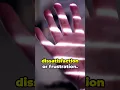 Itchy Left Foot Meaning - Unraveling Superstition