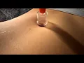 Suction belly button play