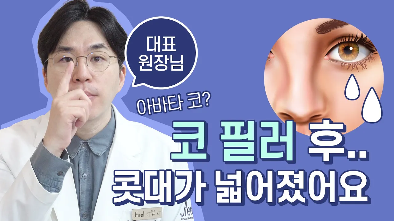 [코필러후유증..] 필러 궁금증 3편! 코필러를 맞고 콧대가 퍼졌어요 ㅠㅠ