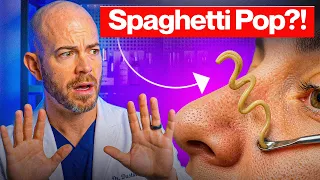 10 Minutes of INSANE Pimple Pops (Dermatologist Reacts)
