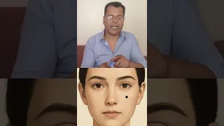 شامة علي الخد علم الفراسة دندنها