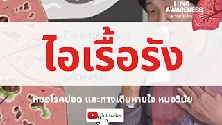 อาการไอเรื้อรังที่ไม่หาย แม้ตรวจเอ็กซ์เรย์ปอดและเก็บเสมหะแล้วปกติ มักเกิดจากสาเหตุหลักใดบ้าง