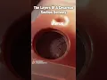 Layers of C-Section Delivery FASCINATING