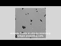 Unique Time-lapse of Dynabeads Activating T-Cells