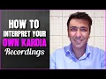 How to interpret your own Kardia recordings