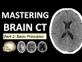 Mastering Brain CT part 1 Basic Principles