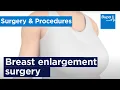How breast enlargement surgery is carried out Bupa Health