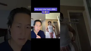 BBL Butt Lift REAL or SUS What Do You Think