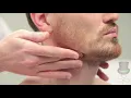 Download Lagu Onderzoek van de lymfeklieren van hoofd en hals