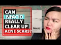 10 THINGS YOU NEED TO KNOW ABOUT NIACID Niacid by Slurp Review Part II