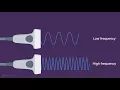 Ultrasound Physics Explained - Axial and Lateral Resolution