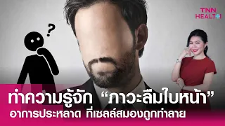  โรคลืมใบหน้าเกิดจากสาเหตุอะไรบ้าง 