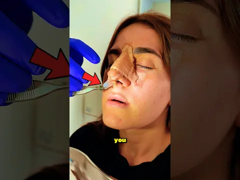 Why Doctors Put Plastic Inside Your Nose ‼😱 #shorts