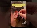 Download Lagu CUSTOM MADE #titanium #CIC #hearingaids from #phonak #audiologycentral #youdoyou #hearinbrooklyn
