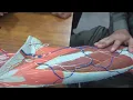Download Lagu Lor Lim Model OSPEMBBS BDS suspension #medicaldoctor #cmbbs #doctor #anatomy #mbbsprivatecolleges 