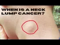 Could My Neck Lump Be Cancer Such as Lymphoma