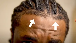 How To Get The Perfect Front Taper Hairline Side Taper Back Taper Braids Dreads Twist Afro