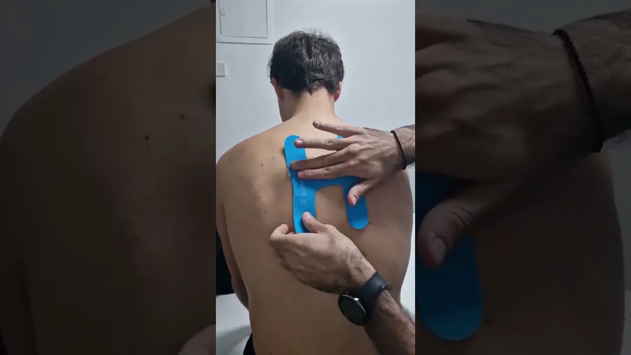 Taping The Upper Back.