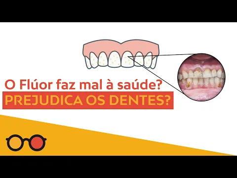 Download MP3 Descubra se o flúor prejudica os dentes! E o creme dental?