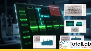 Automatic Band Detection Rf Value Calculation in SDS-PAGE Phoretix 1D Tutorial