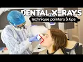 Download Lagu How To Take PERFECT Dental X-rays | Tips \u0026 Tricks From A Dental Hygienist