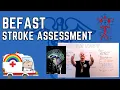 BE-FAST Stroke Assessment Explained Why the FAST test is not good enough