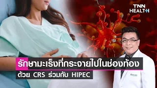 การรักษาโรคมะเร็งที่กระจายไปยังช่องท้องมีวิธีใดบ้าง