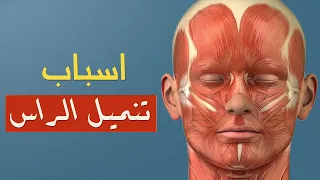 الاطباء يكشفون عن 10 أسباب وراء الشعور بتنميل الرأس لن تصدق بعضها 