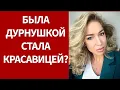 Download Lagu Её называли дурнушкой а она вошла в список самых красивых женщин России — операции Надежды Ермаковой