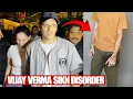 Lagu Vijay Varma Has Skin Disorder Vitiligo | Hide in Movies 😱
