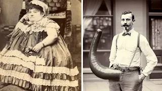 15 Most Disturbing Circus Sideshow Freaks