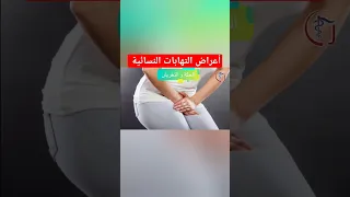 أعراض الالتهابات النسائية ستنصدمي من وجودها 